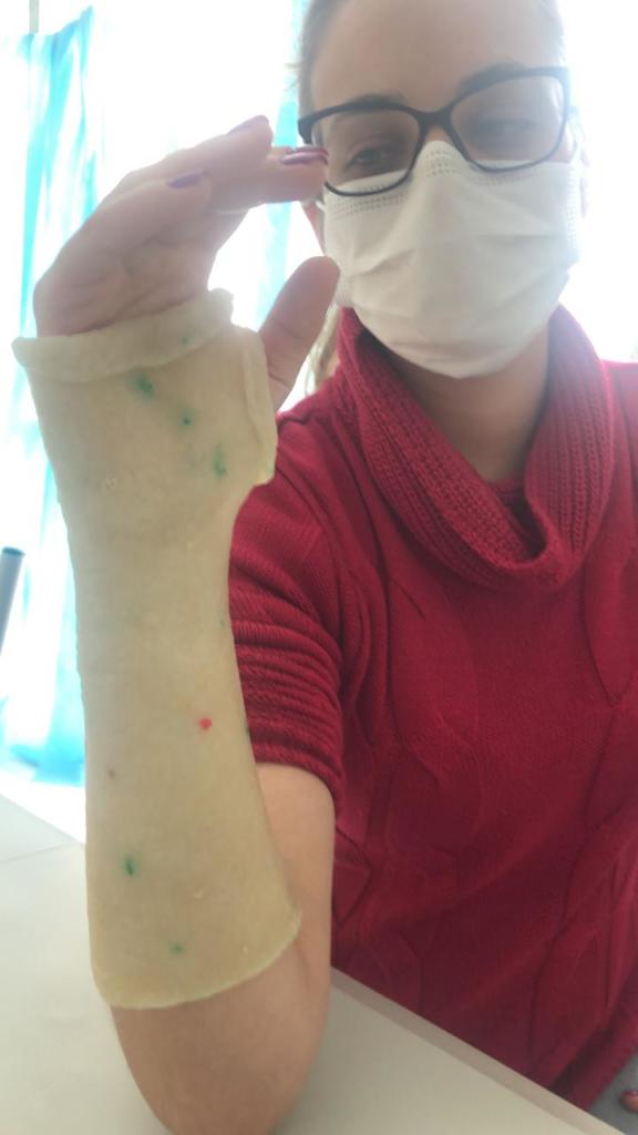 Foto de mulher sentada, com óculos de grau e máscara branca. Em primeiro plano, o braço direito erguido sobre a mesa. O braço está coberto por um material termoplástico